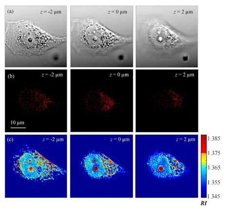 A Differential Interference Contrast Dic Microscopic Images Of A