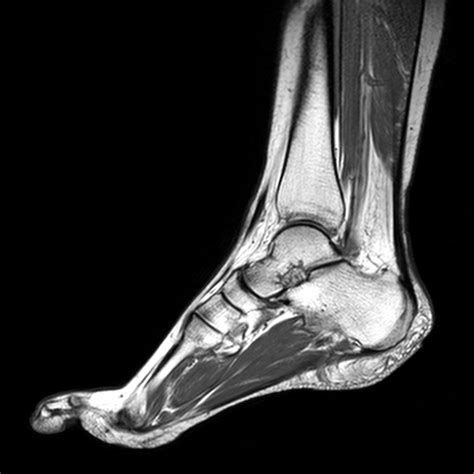 Magnetic resonance imaging—mri—uses magnetic fields and radio waves to examine the internal structures of your body. MRI Sliders - MRI - Anatomic Imaging of the Foot - MR-TIP.com