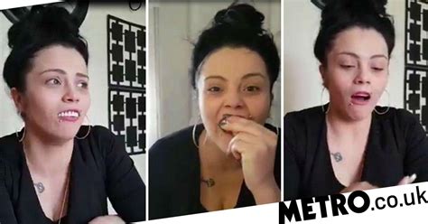Woman Learns The Hard Way Not To Buy £5 Veneers Off Ebay In Hilarious