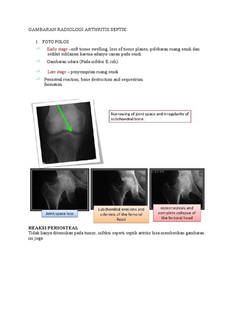 Gambaran Radiologi Arthritis Septik Pdf