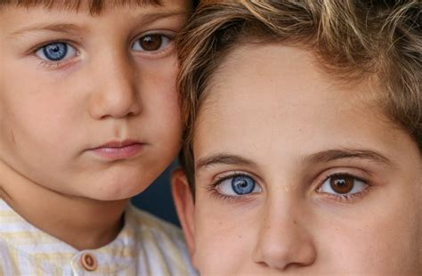 Flipboard Amazing Pictures Of Brothers Both Born With One Brown Eye And One Blue