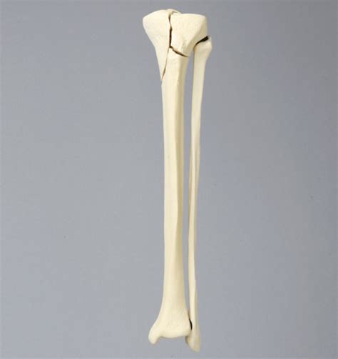 Fracture Types Tibia And Fibula Bone Models Visually Aid In Reduction