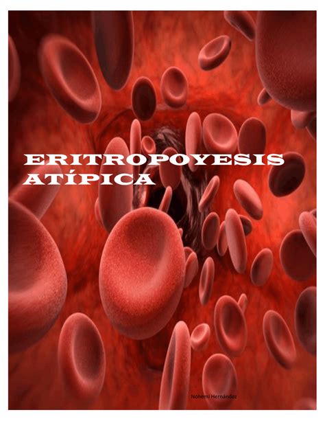 Eritropoyesis Atipica Docsity