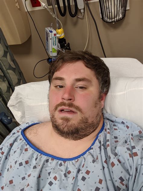 Matthercsmash On Twitter Went To The Hospital Leg Is Probably