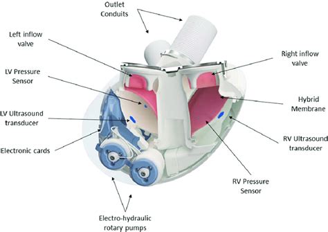 Artificial Heart Diagram