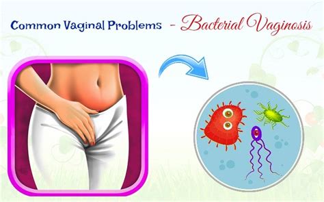 Top Common Vaginal Problems That You Should Know