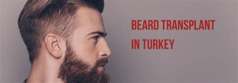 Beard Transplant In Turkey Top Clinics Prices Reviews