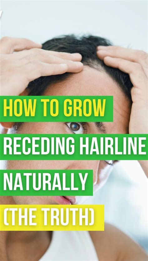 How To Cure Receding Hairline Naturally A Comprehensive Guide Best Simple Hairstyles For Every