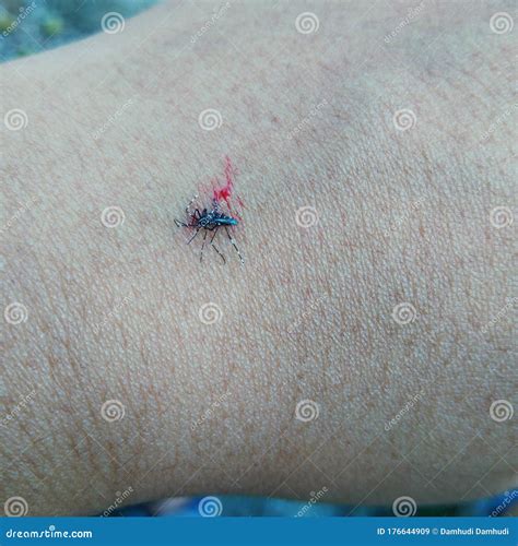 Smash Mosquito Until Die After Drunk Blood Stock Image Image Of Small