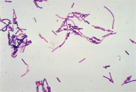 Bacillus Cereus Gram Staining Doccheck Pictures