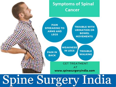What Are The Symptoms Of Spinal Cancer