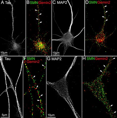 Multiprotein Complexes Of The Survival Of Motor Neuron Protein Smn With