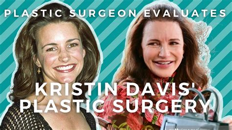 Kristin Davis Plastic Surgery Did Charlotte From Satc Have Work Done