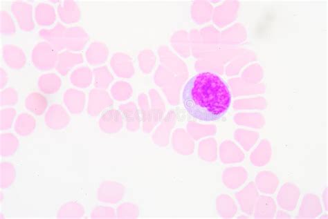 Reactive Lymphocytes Stock Image Image Of Hemoglobin 50489789