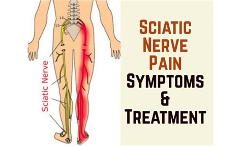 Sciatica Pain Relief With A Tens Machine Massage Therapy Concepts