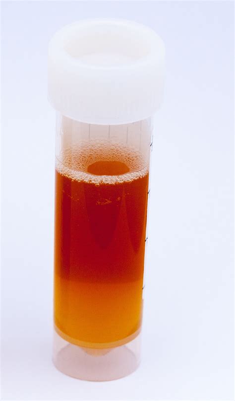 Heavy bleeding during menopause is not normal under any circumstances and could actually mean cancer. What Blood in Urine Means » Scary Symptoms