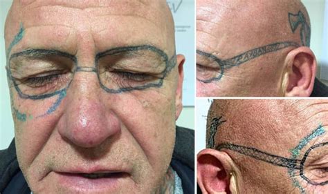 Man Wakes Up After Stag Do With Ray Ban Glasses Tattooed On His Face