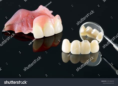 481 Partial Denture Upper Images Stock Photos And Vectors Shutterstock