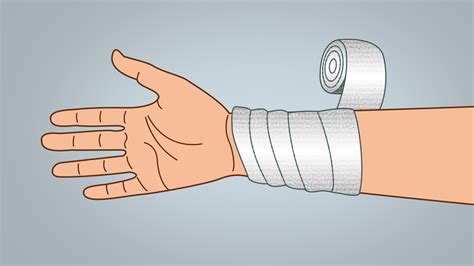 Bandage Wrapping Techniques