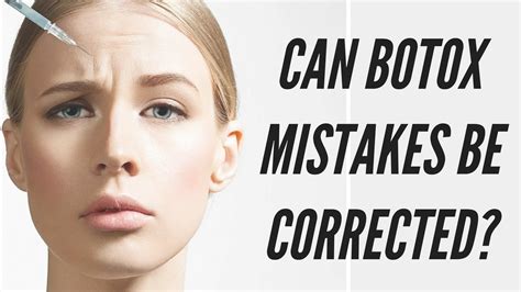 Can Botox Mistakes Be Corrected Botox Toronto Dr Torgerson Youtube