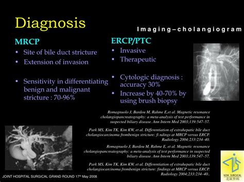 Ppt Management Of Cholangiocarcinoma Before Surgery Powerpoint
