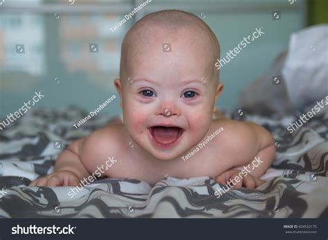Portrait Cute Baby Boy Down Syndrome Stock Photo 604522175 Shutterstock