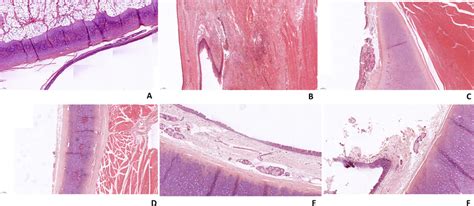 Histopathological Examination Of Laryngeal Tissue In Group Ii A