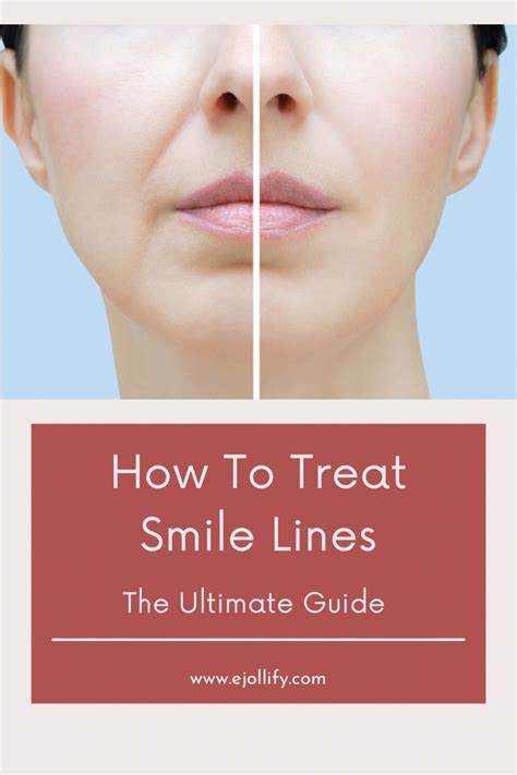 How To Prevent Smile Lines Otosection