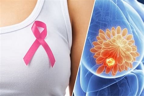 14 Sinais que Podem Indicar um Câncer de Mama Dicas de Saúde