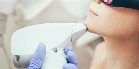 How does ideal laser™ hair removal work? Laser Hair Removal Facts and Cost - What to Know Before ...