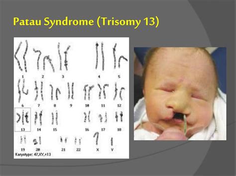 Ppt H Uman Chromosome And Chromosome Behavior Powerpoint Presentation Id2170878