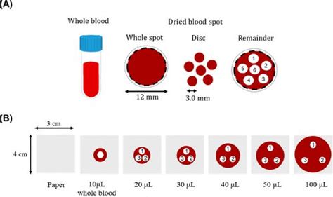 Research Team Develops Dried Blood Spot Crm For Newborn Screening All