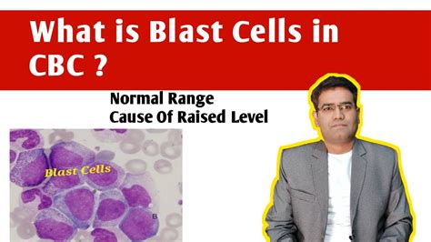 What Is Blast Cells In Cbc Normal Range Causes Of High Blast In
