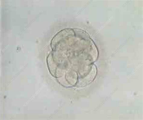 Multi Celled Embryo Light Micrograph Stock Image P