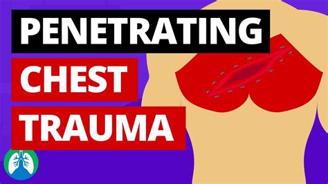 Penetrating Chest Trauma Medical Definition Quick Explainer Video Youtube