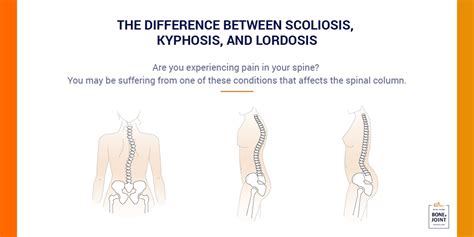 Kyphosis Lordosis Scoliosis