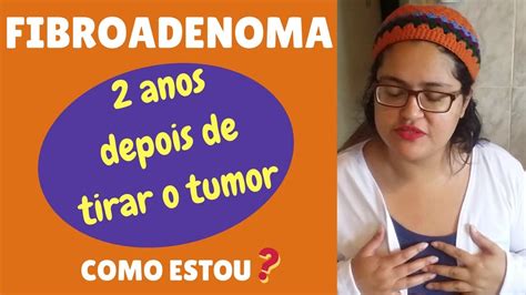 Fibroadenoma Anos Ap S Retirada Do Tumor Da Mama Como Estou Contando Tudo Youtube