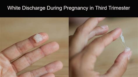 What Does Discharge Look Like During Pregnancy Pregnancywalls
