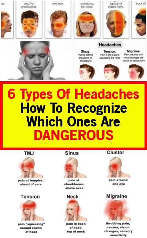 Headache Nausea Back Pain Headache