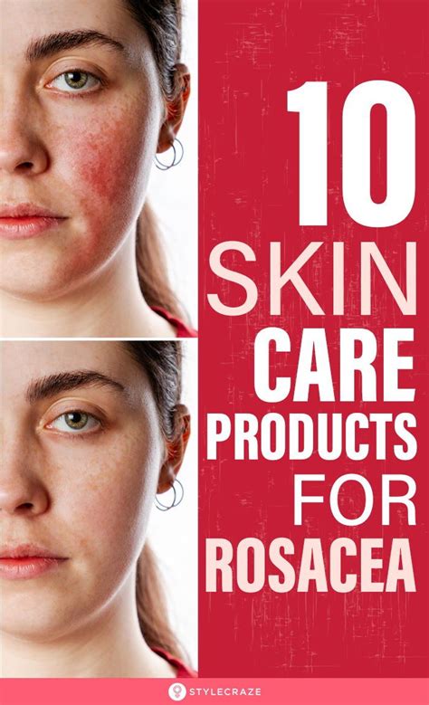 The 15 Best Skin Care Products For Rosacea Of 2020 In 2020 Rosacea