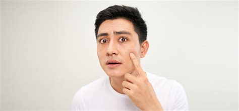 5 Common Dry Skin Problems In Men