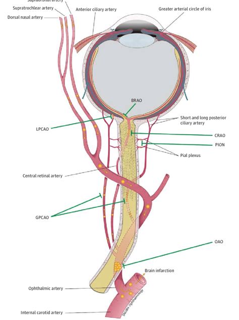 Schematic Drawing Of The Ophthalmic Artery Its Branches And Possible