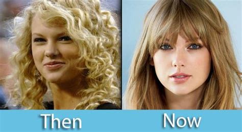 Nose Job Celebrity Plastic Surgery Taylor Swift