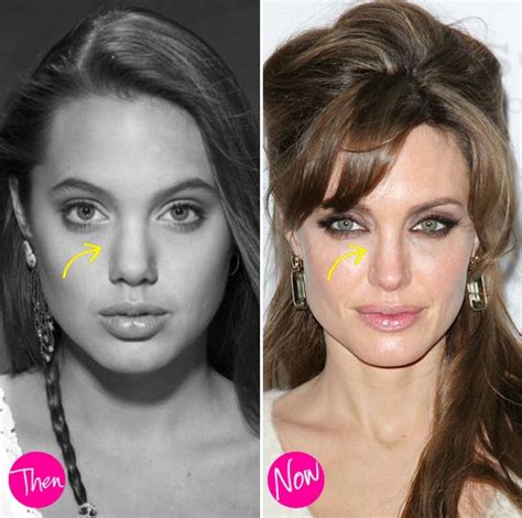 Angelina Jolie Before Her Rhinoplasty Such A Subtle Change That Made