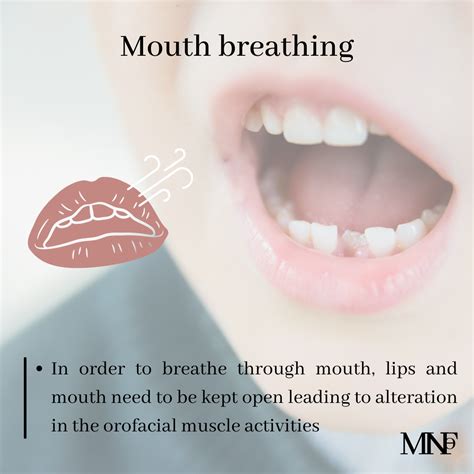 Effects Of Mouth Breathing On Orofacial Muscles Of Children