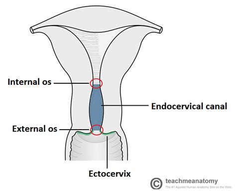 Cervical Ectropion Causes Investigations Management Teachmeobgyn