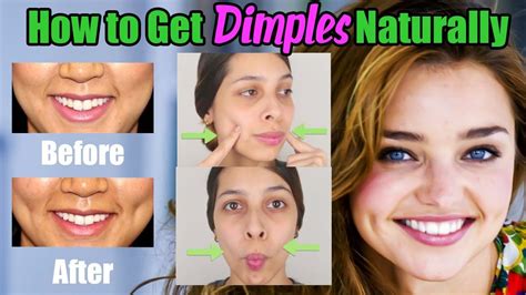 How To Get Dimples On Cheeks Naturally At Home Blogrotu