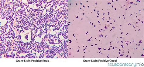 Gram Positive Rods