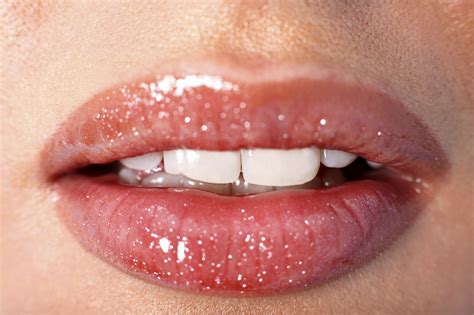 Symptoms Of Sunburned Lips And Effective Ways To Treat Them