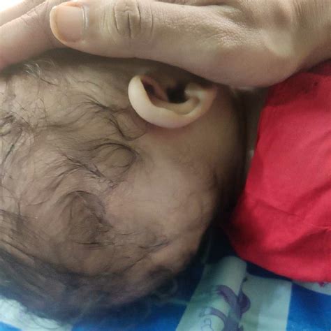 These symptoms can also include hot flashes, night sweats, mood swings, insomnia, and vagina. 54 Top Images Do Babies Lose Their Hair / Infant Hair Loss ...